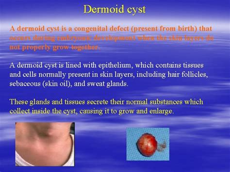 Differential Diagnosis Of Head And Neck Swellings And