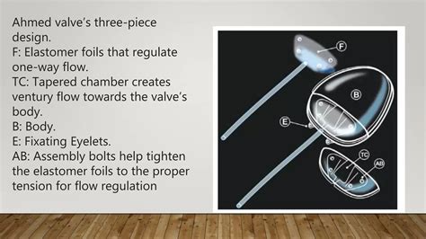 Glaucoma Drainage Devices Pptx