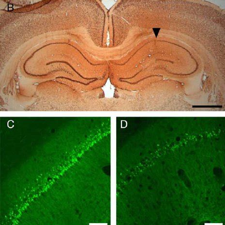 Eiav Gdnf Protects Rat Hippocampal Neurons Against Nmda Excitotoxicity