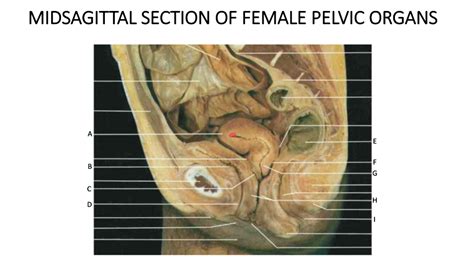 Midsagittal Section Of Female Pelvic Organs Diagram Quizlet