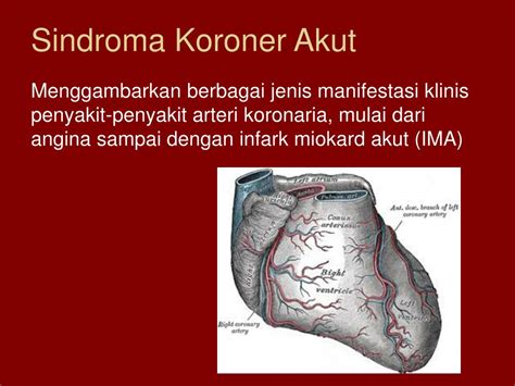 Ppt Sindroma Koroner Akut Powerpoint Presentation Free Download Id