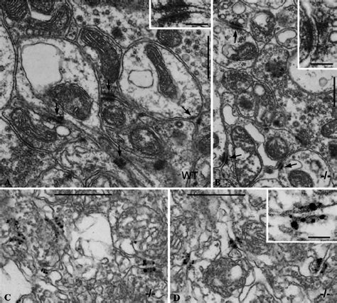 Electron Micrographs Of Ultrathin Sections Through Glomeruli Of