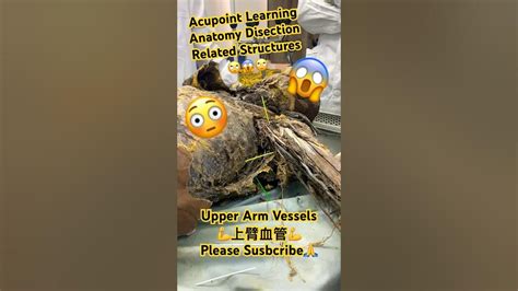 Acupoint Learning📌anatomy Disection😱upper Arm Nearby Structures💪上臂血管