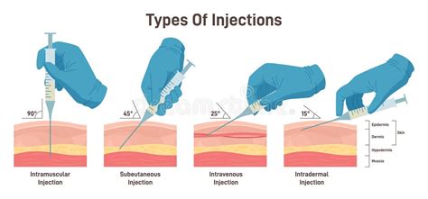 Subcutaneous Injections Of Heparin On The Belly Bare Chested Person