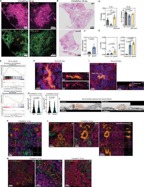 Mechanopathology Of Biofilm Like Mycobacterium Tuberculosis Cords Cell