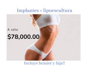 Precio De Lipoescultura Multiestetica Mx