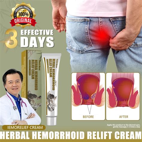 Hemorrhoids Cream Almoranas Ointment Original Hemorrhoid Spray Miracle