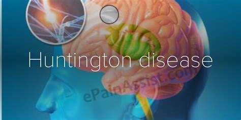 Huntington Disease