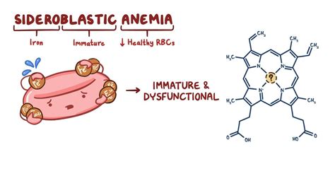 Sideroblastic Anemia Pathophysiology