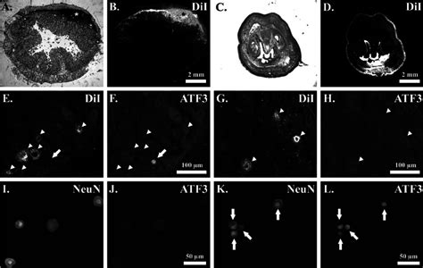 Dii Labeling In The Distal Colon And Glans Penis Distal Urethra Bright