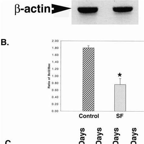 Effect Of Serum Deprivation Of Rgc 5 Cells On Bcl 2 And Bax Mrna