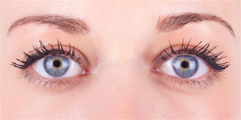 Ptosis/Drooping Eyelid stock image. Image of ptosis, droopy - 33289621