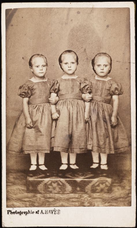 Conjoined Triplets - OdditiesBizarre.com