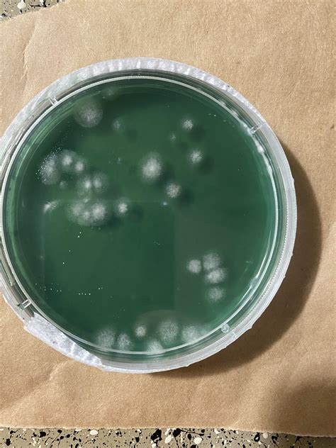 Is This Mycelium This Is My First Time Working With Agar This Is Mss