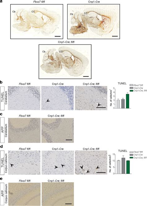 Figure 1 From Myelinating Glia Specific Deletion Of Fbxo7 In Mice