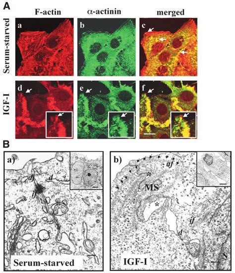 A Colocalization Of Actinin With F Actin In Microspikes During