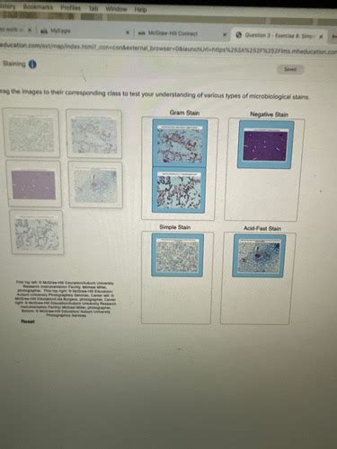 Micro Lab Simple Staining Flashcards Quizlet