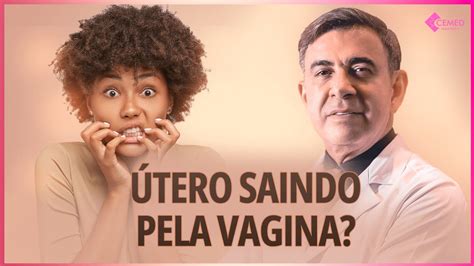 ÚTERO SAINDO PELA VAGINA VOCÊ SABE O QUE É PROLAPSO UTERINO YouTube