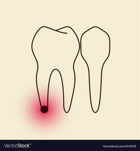 toothache pulpitis royalty  vector image vectorstock