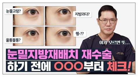 ⁕눈밑지 재수술 유형 총정리⁕ 이런 경우는 눈밑지방재배치 재수술 제대로 해야합니다 유형별 해결법까지 Youtube