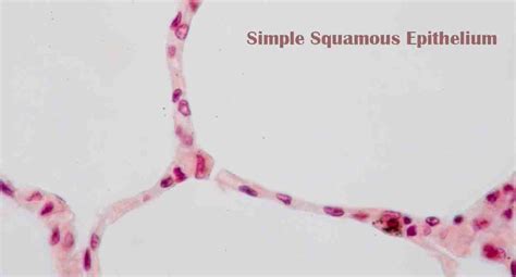 Simple Squamous Epithelium Wise Ways To Study