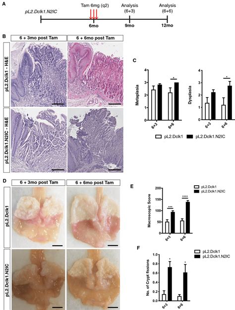 Notch Activation In Dclk1 Positive Gastric Tuft Cells Accelerates Be