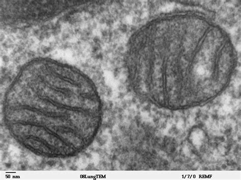 Do Plant Cells Have Mitochondria Smore Science Magazine