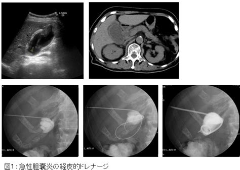 超音波検査を用いた診断・治療｜診療部 消化器内科｜明石医療センター