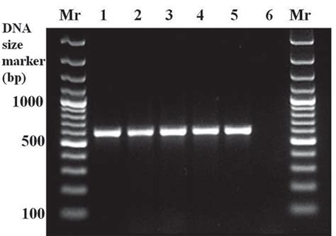 Agarose Gel Electrophoresis Of Amplified Products Of 16s Rrna Of