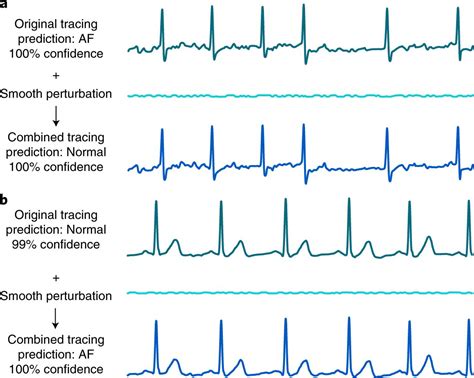 Deep Learning Electrocardiogram Devices Found To Be Susceptible To