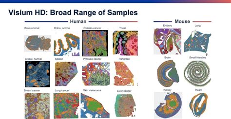 Visium Hd Spatial Gene Expression X Genomics