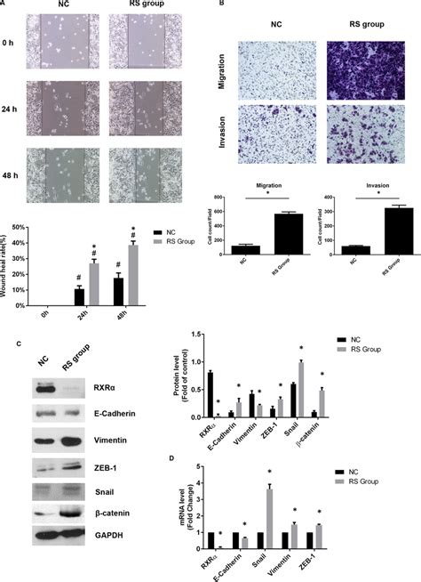 Deficient Rxrα Promoted Epithelial‐mesenchymal Transition In Sw480 Download Scientific Diagram