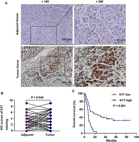 Frontiers Keratin Suppresses Cell Proliferation And Epithelial