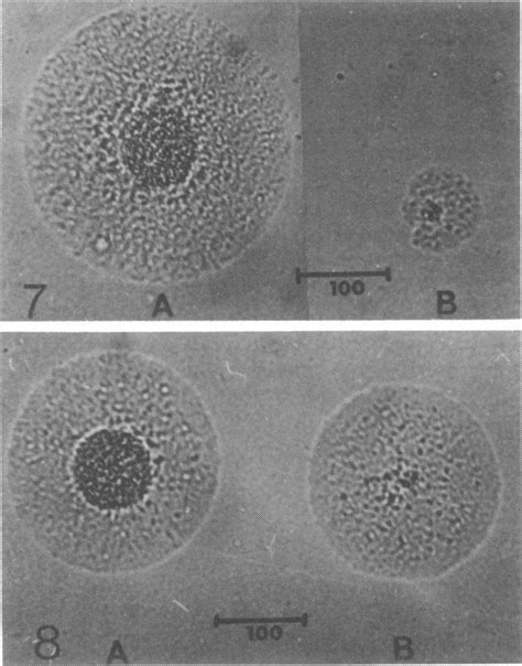 And Colonies Of M Hominis Strain Pg A And Human T Strain