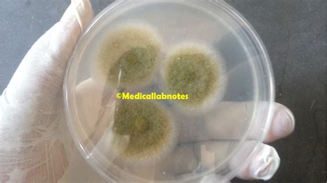 Aspergillus Niger On Pda