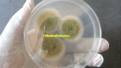 Aspergillus Niger Colony Morphology On Pda Archives Medical Notes