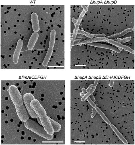 Role Of Hu In The Formation Of Type I Fimbriae On The Surface Of E Download Scientific Diagram