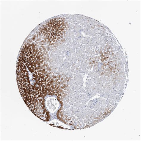 Tissue Expression Of Cyp A Staining In Liver The Human Protein Atlas