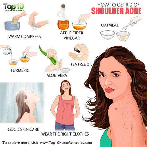 How to Manage & Prevent Shoulder Acne - eMediHealth | Shoulder acne, Back acne remedies, Body ...