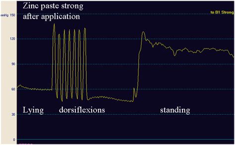 Compression For The Management Of Venous Leg Ulcers Which Material Do