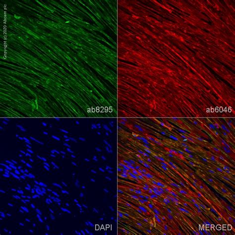 Cardiac Troponin T C Ab Abcam