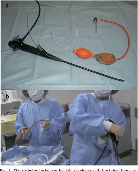 Figure 1 From New Ideas Thoracic Oncologic Novel Approach For Talc Pleurodesis By Dedicated