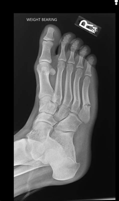 Orthodx Recurring Foot Pain