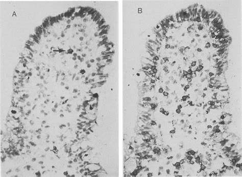 A Immunoperoxidase Staining In The Absence Of Monoclonal Antibody