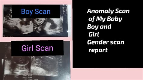 Baby Boy And Baby Girl Anomaly Scan Report For Gender Anomaly Scan For