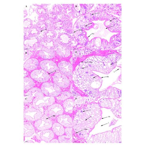 Histological Characteristics In The Hepatopancreas Of Scylla