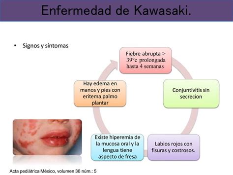 Enfermedades Exantematicas En La Infancia PPT