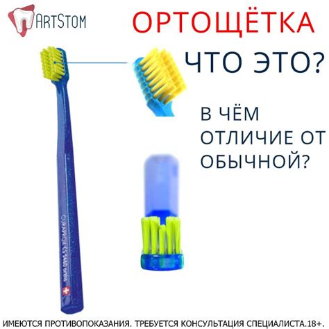 👆В уходе за брекетами не рекомендуется использовать излишне жесткую ...