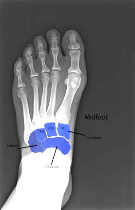 Ankle Bones X Ray