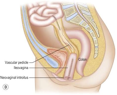 Gender-Affirming Genitourinary Surgery and Associated Care - Physician